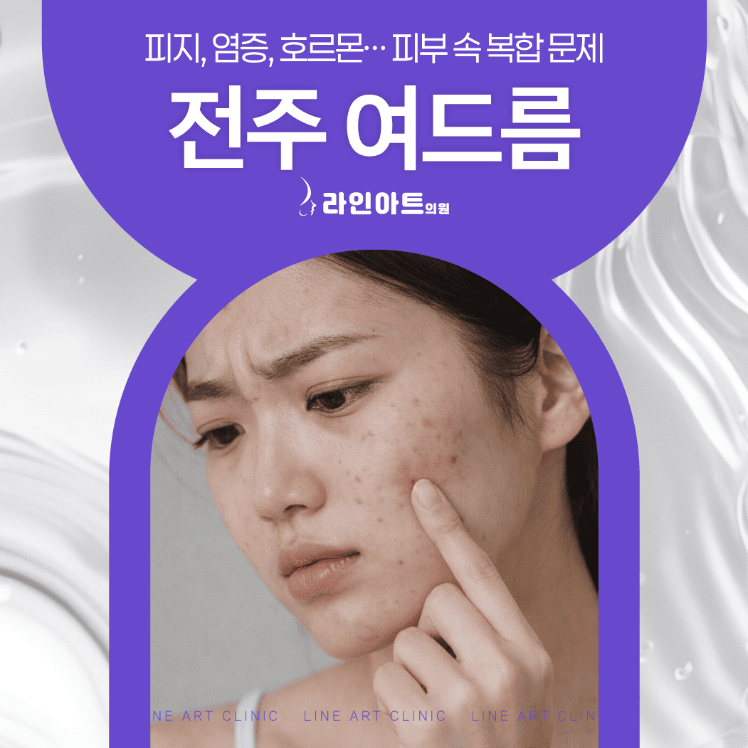 전주 여드름 피부과 치료 방법 정리