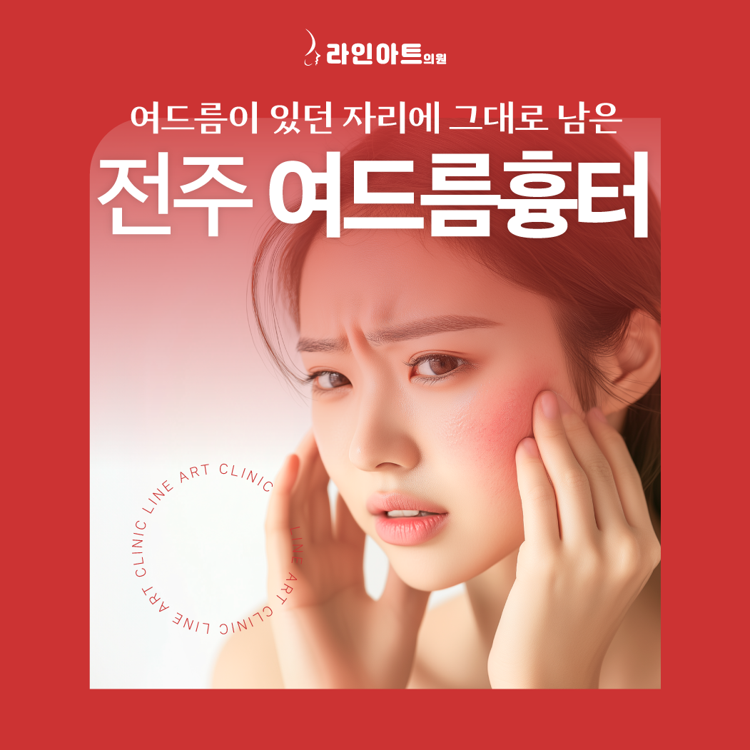 전주 여드름 흉터 치료 종류별 다른 접근 방법